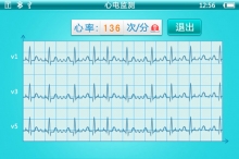 心电图能灵敏提示不少疾病