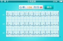 动态心电图与常规心电图在糖尿病性冠心病诊断中的比较分析 ... ...